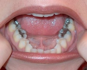 tucson dental