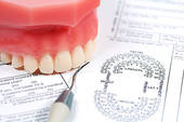 Dental Insurance and Dental Forms